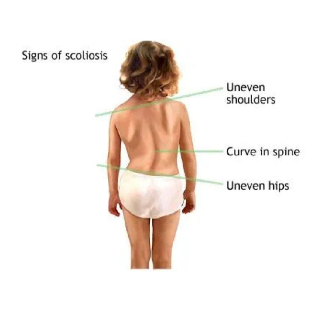 muscular dystrophy treatment in india