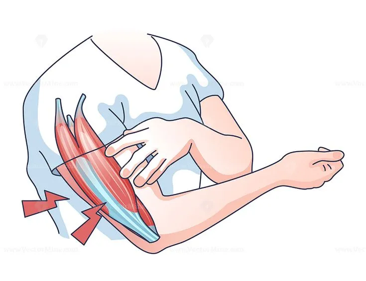 Treatment access for muscular dystrophy